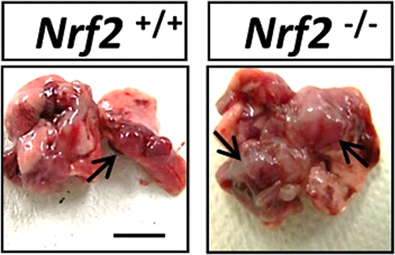 Nrf2 in stress response and cancer development