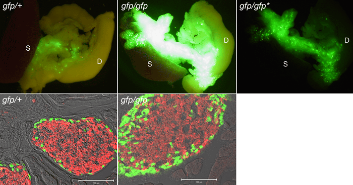 Metabolic impact of glucagon deficiency