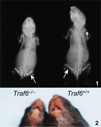 Critical roles of TRAF6